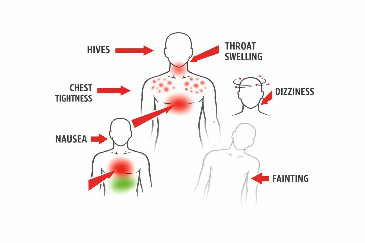 infographic showing body warning signs of severe allergic reaction to bee venom