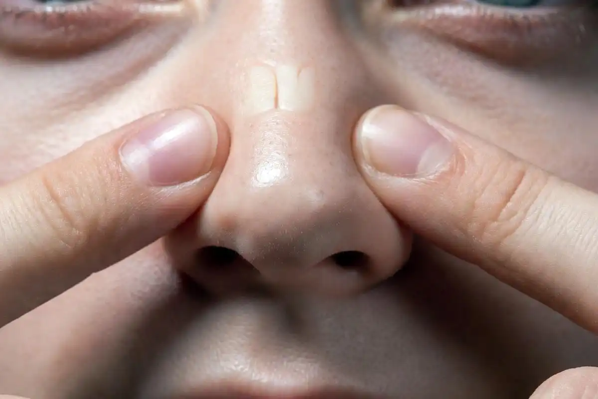 correct nose pinch technique for nosebleed first aid