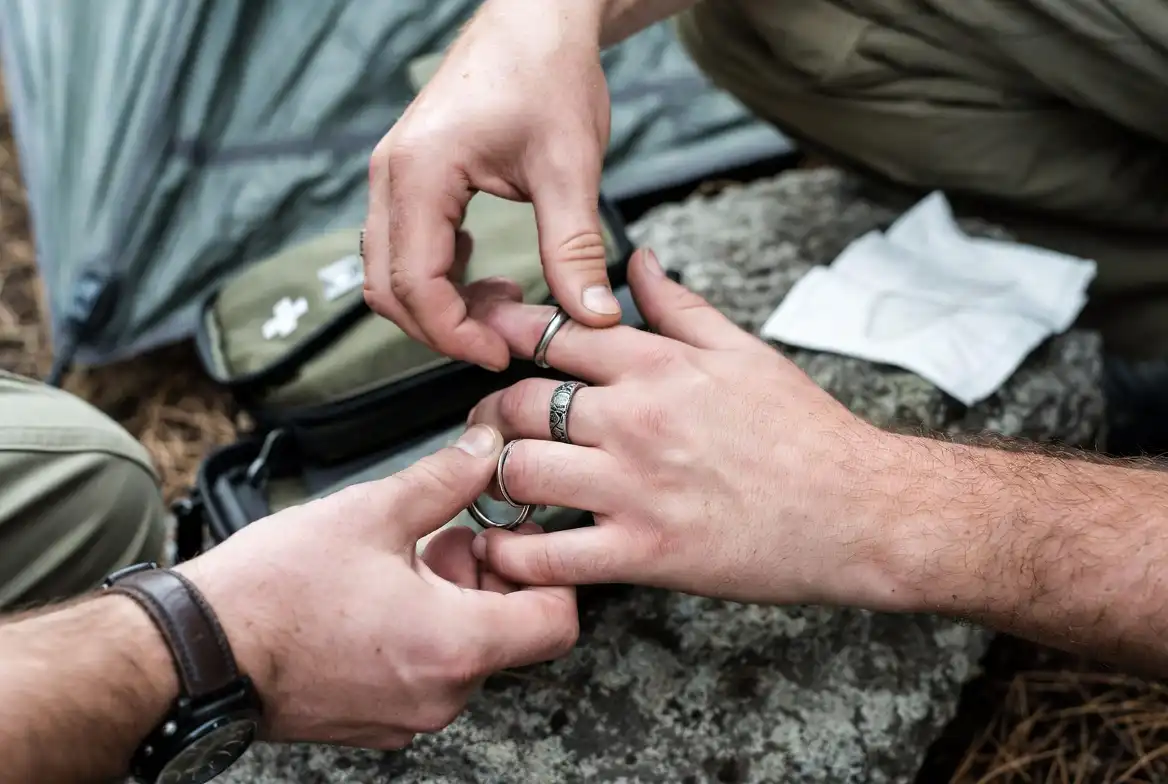 hands removing rings and watch before swelling