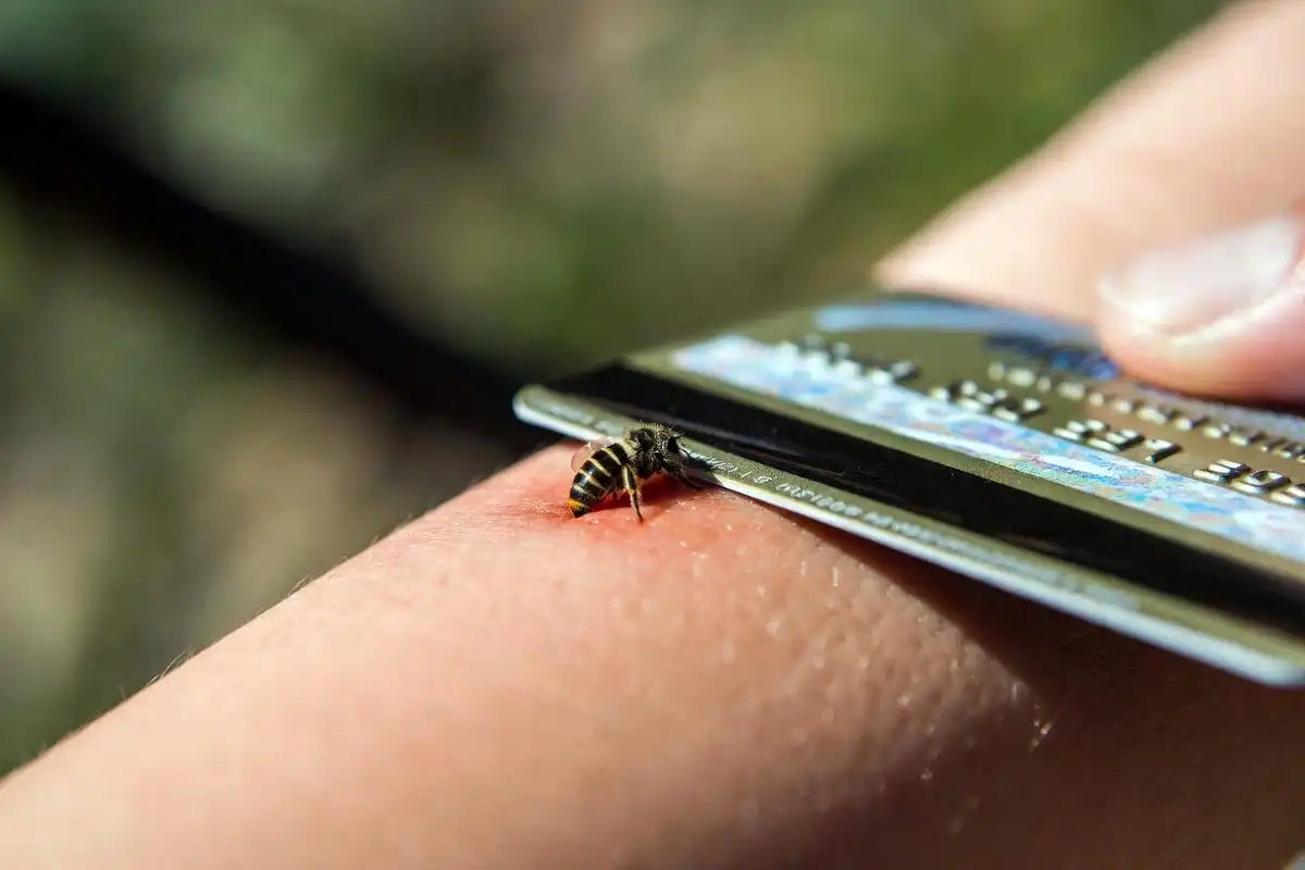 scraping bee stinger out of skin using edge of credit card